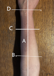 measuring arm diagram